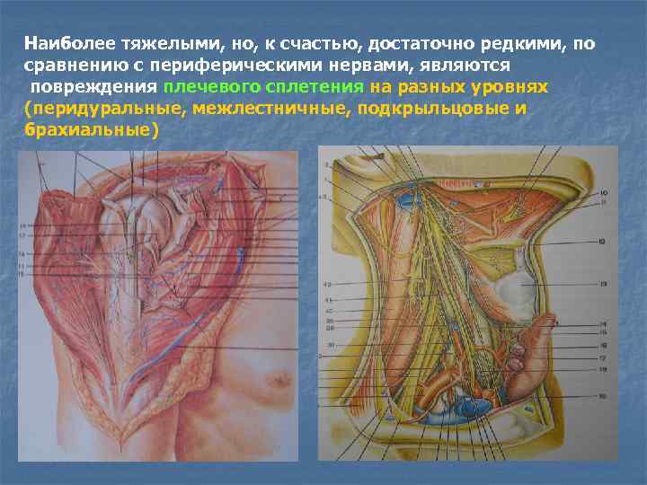 Наиболее тяжелыми, но, к счастью, достаточно редкими, по сравнению с периферическими нервами, являются повреждения