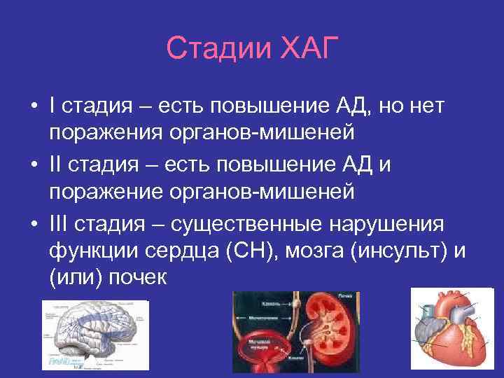 Стадии ХАГ • I стадия – есть повышение АД, но нет поражения органов-мишеней •