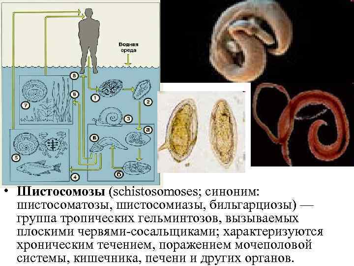  • Шистосомозы (schistosomoses; синоним: шистосоматозы, шистосомиазы, бильгарциозы) — группа тропических гельминтозов, вызываемых плоскими
