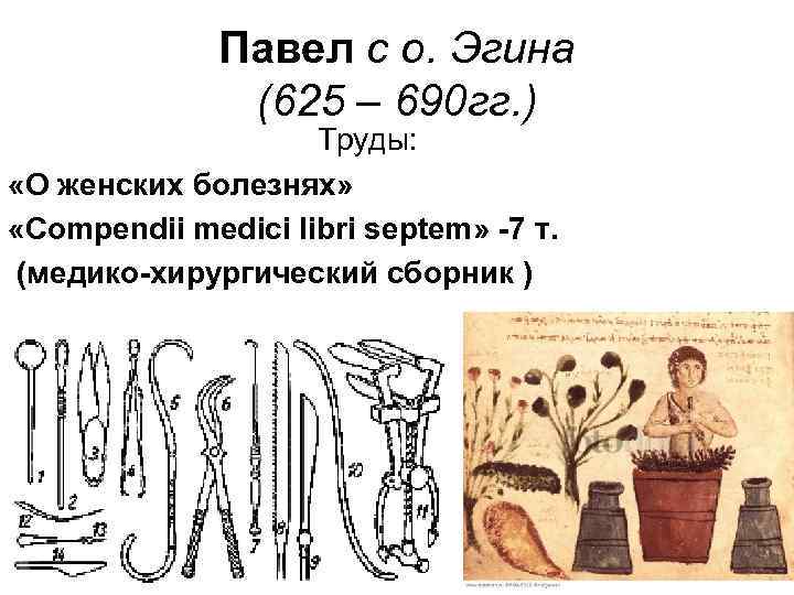 Павел с о. Эгина (625 – 690 гг. ) Труды: «О женских болезнях» «Compendii