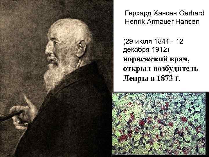 Герхард Хансен Gerhard Henrik Armauer Hansen (29 июля 1841 - 12 декабря 1912) норвежский