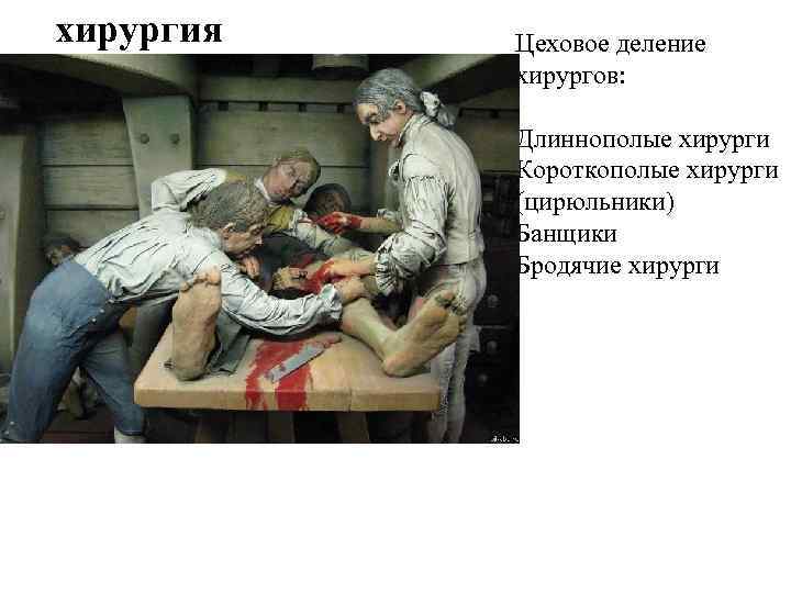 хирургия Цеховое деление хирургов: Длиннополые хирурги Короткополые хирурги (цирюльники) Банщики Бродячие хирурги 