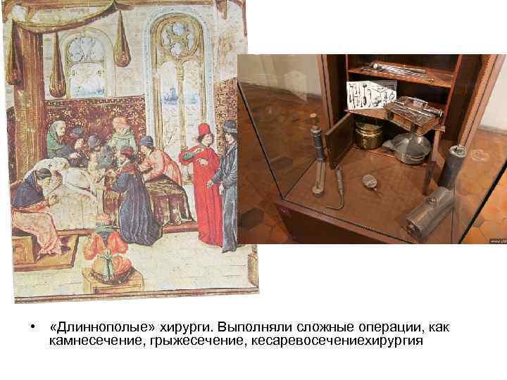  • «Длиннополые» хирурги. Выполняли сложные операции, как камнесечение, грыжесечение, кесаревосечениехирургия 