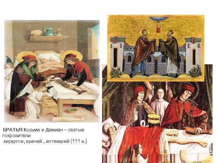 БРАТЬЯ Косьма и Дамиан – святые покровители хирургов, врачей , аптекарей (111 в. )