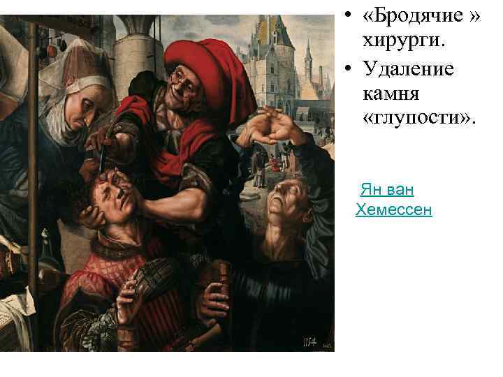  • «Бродячие » хирурги. • Удаление камня «глупости» . Ян ван Хемессен 