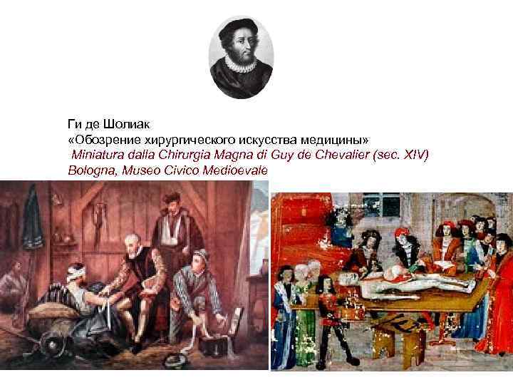 Ги де Шолиак «Обозрение хирургического искусства медицины» Miniatura dalla Chirurgia Magna di Guy de
