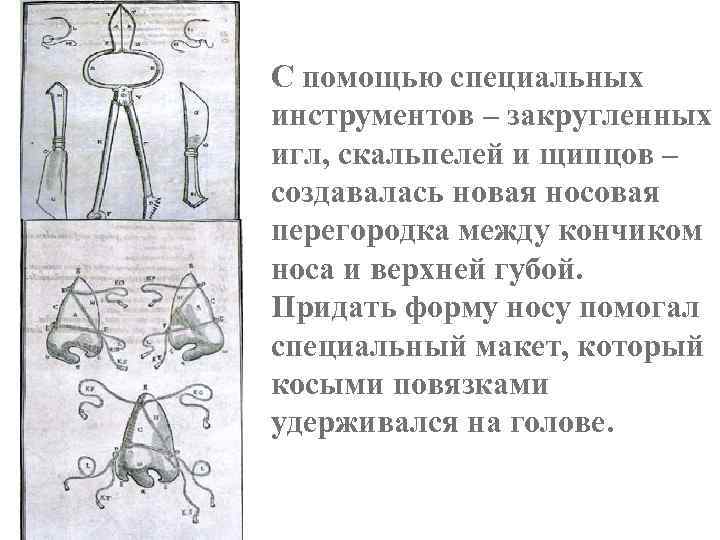 С помощью специальных инструментов – закругленных игл, скальпелей и щипцов – создавалась новая носовая