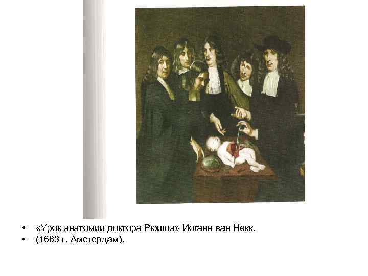  • • «Урок анатомии доктора Рюиша» Иоганн ван Некк. (1683 г. Амстердам). 