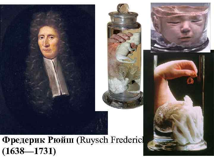 Фредерик Рюйш (Ruysch Frederick) (1638— 1731) 