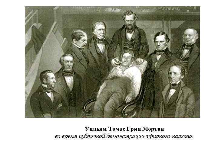 Уильям Томас Грин Мортон во время публичной демонстрации эфирного наркоза. 