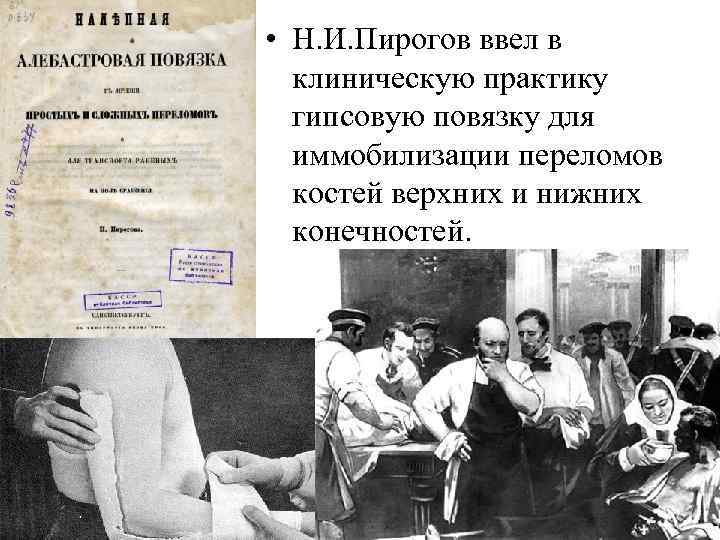  • Н. И. Пирогов ввел в клиническую практику гипсовую повязку для иммобилизации переломов