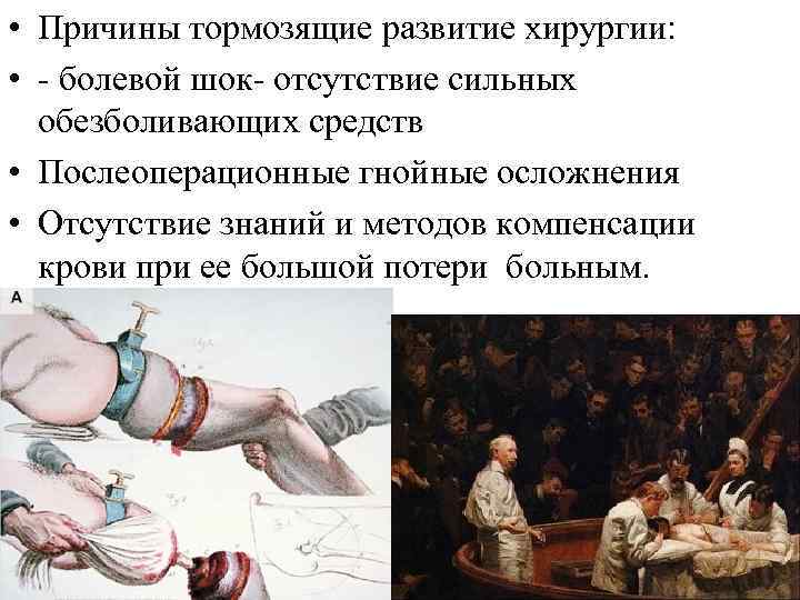  • Причины тормозящие развитие хирургии: • - болевой шок- отсутствие сильных обезболивающих средств