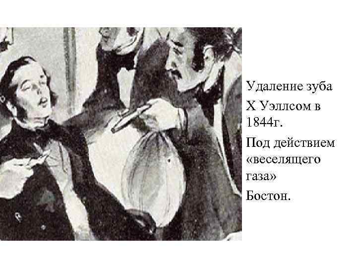  • Удаление зуба • Х Уэллсом в 1844 г. • Под действием «веселящего