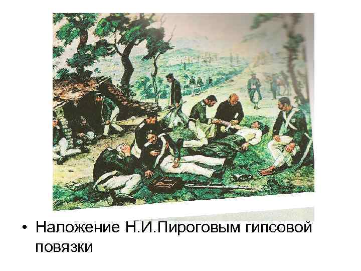  • Наложение Н. И. Пироговым гипсовой повязки 