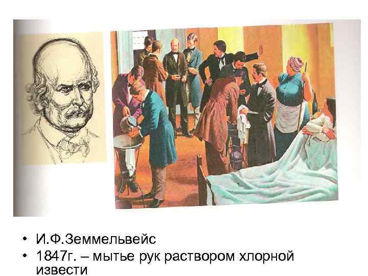  • И. Ф. Земмельвейс • 1847 г. – мытье рук раствором хлорной извести