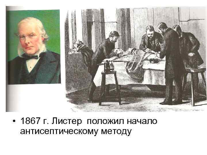  • 1867 г. Листер положил начало антисептическому методу 