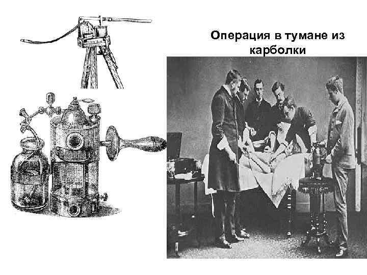 Операция в тумане из карболки Листеровский пульверизатор - 