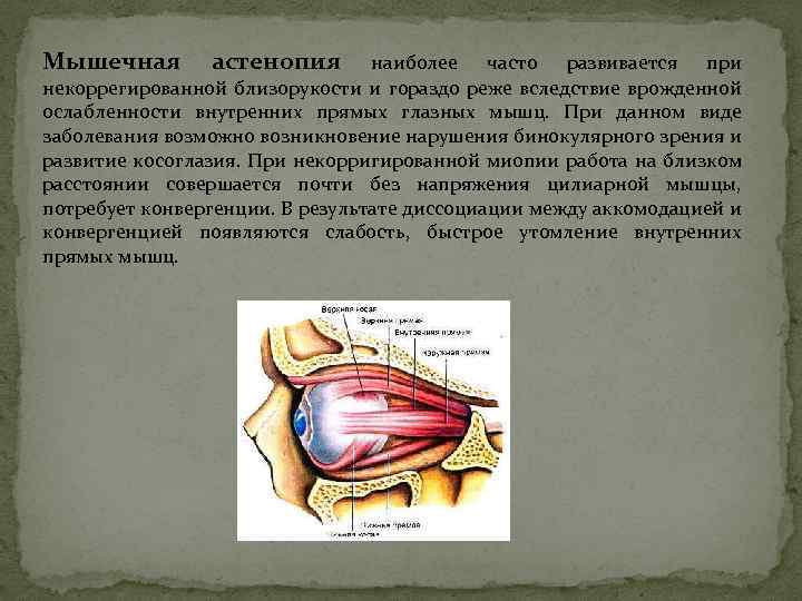 Мышечная астенопия наиболее часто развивается при некоррегированной близорукости и гораздо реже вследствие врожденной ослабленности