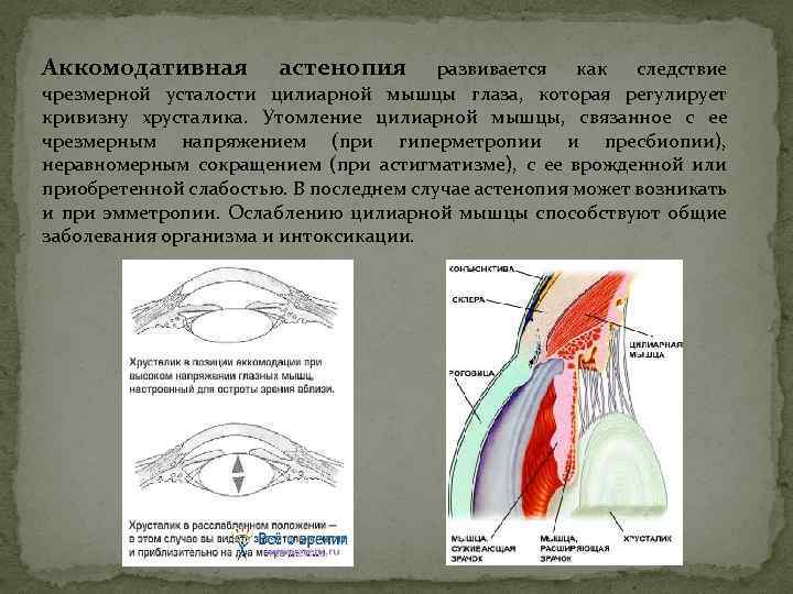 Аккомодативная астенопия развивается как следствие чрезмерной усталости цилиарной мышцы глаза, которая регулирует кривизну хрусталика.