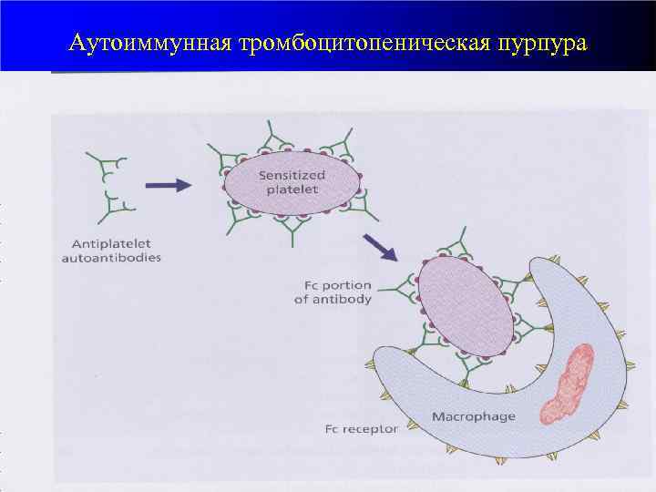 Аутоиммунная тромбоцитопеническая пурпура • • Этиология: продукция антител, тропных к собственным тромбоцитам. Разрушение меченных