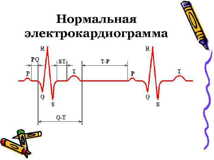 Схема электрической активности сердца является