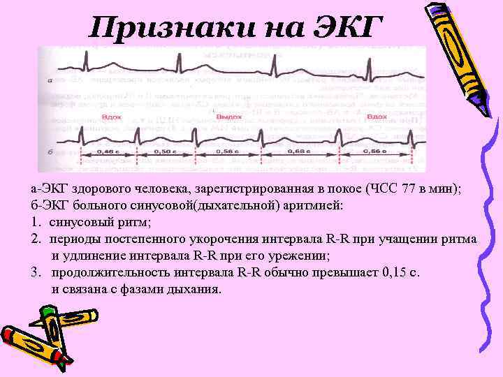 Понятие об экг презентация