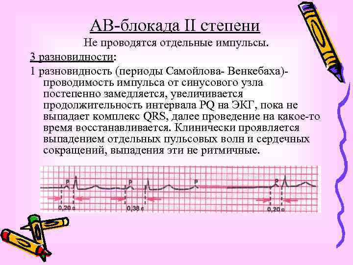 Блокады сердца презентация