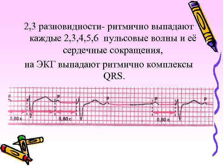 Пульсом называют ритмическое колебание стенок кровеносных