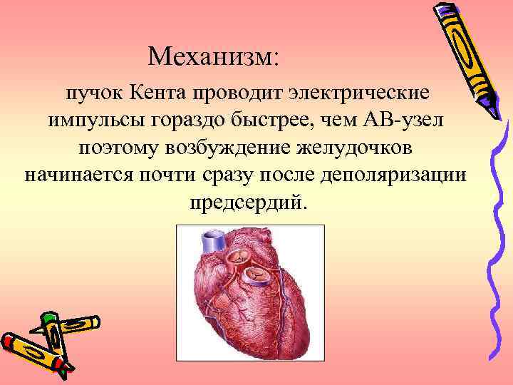 Механизм: пучок Кента проводит электрические импульсы гораздо быстрее, чем АВ-узел поэтому возбуждение желудочков начинается