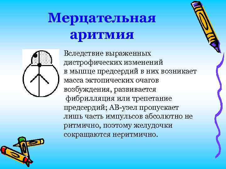 Мерцательная аритмия Вследствие выраженных дистрофических изменений в мышце предсердий в них возникает масса эктопических