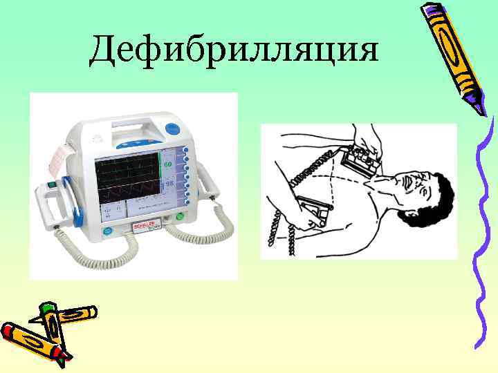 Дфр 1 дефибриллятор схема