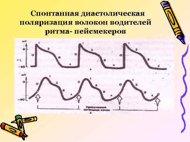 Спонтанная диастолическая поляризация волокон водителей ритма- пейсмекеров 