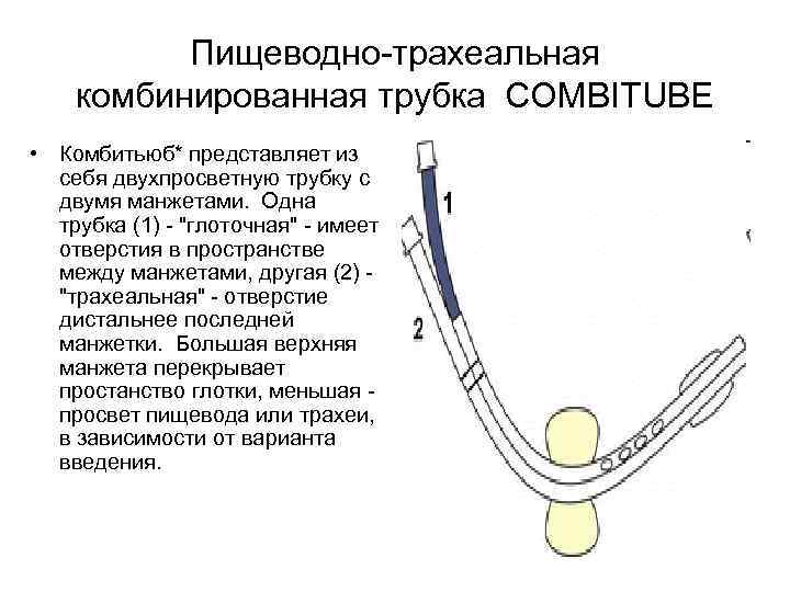 Пищеводно-трахеальная комбинированная трубка COMBITUBE • Комбитьюб* представляет из себя двухпросветную трубку с двумя манжетами.