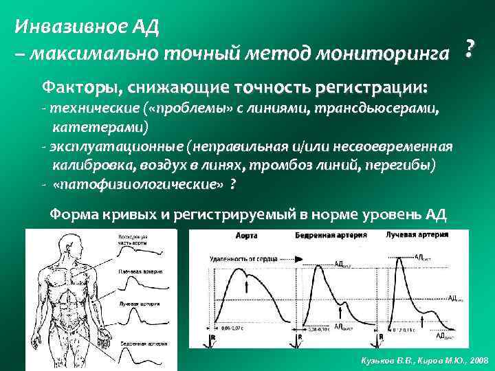 Инвазивное АД – максимально точный метод мониторинга ? Факторы, снижающие точность регистрации: - технические