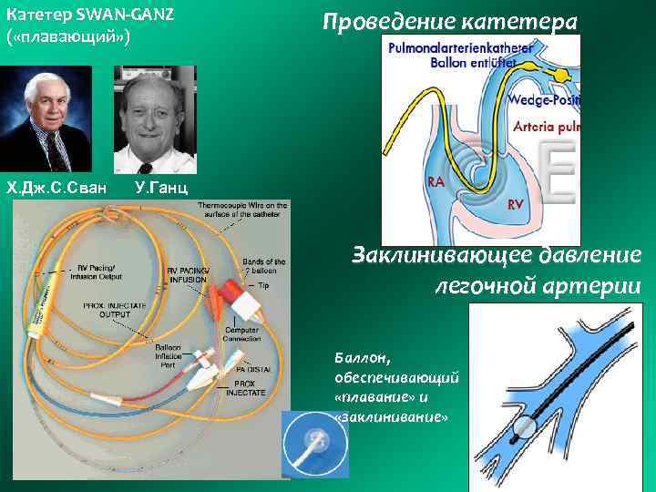 Катетер SWAN-GANZ ( «плавающий» ) Х. Дж. С. Сван Проведение катетера У. Ганц Заклинивающее