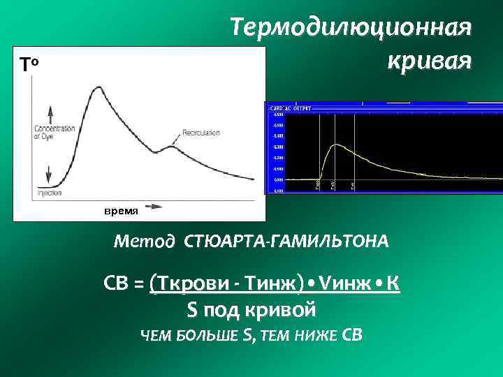 Термодилюционная кривая То время Метод СТЮАРТА-ГАМИЛЬТОНА СВ = (Tкрови - Тинж) • Vинж •