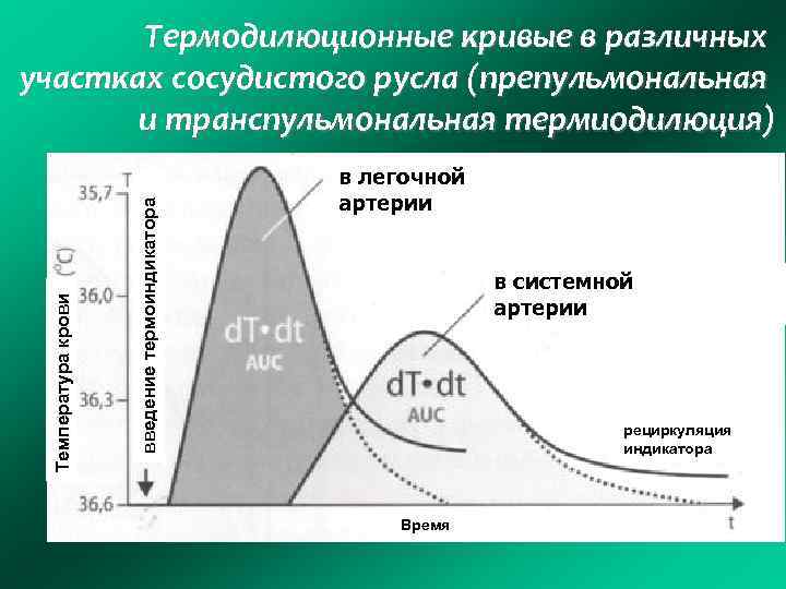 введение термоиндикатора Температура крови Термодилюционные кривые в различных участках сосудистого русла (препульмональная и транспульмональная