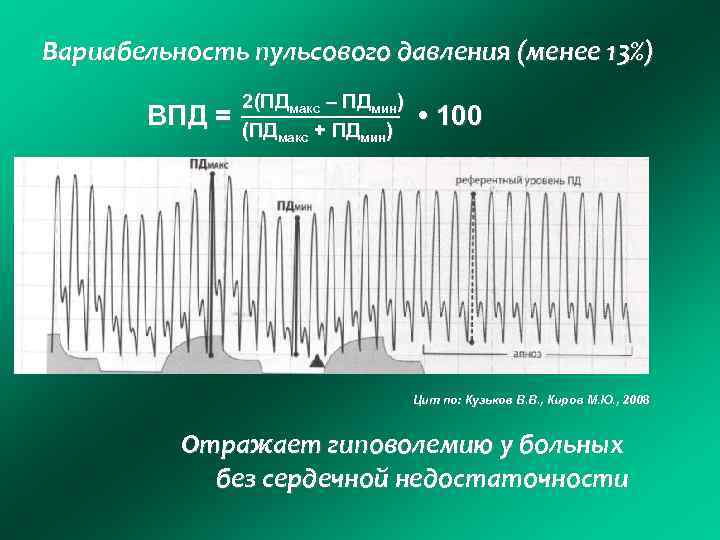 Вариабельность пульсового давления (менее 13%) ВПД = 2(ПДмакс – ПДмин) (ПДмакс + ПДмин) •