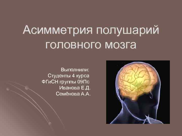 Асимметрия полушарий головного мозга Выполнили: Студенты 4 курса ФГи. СН группы 09 Пс Иванова