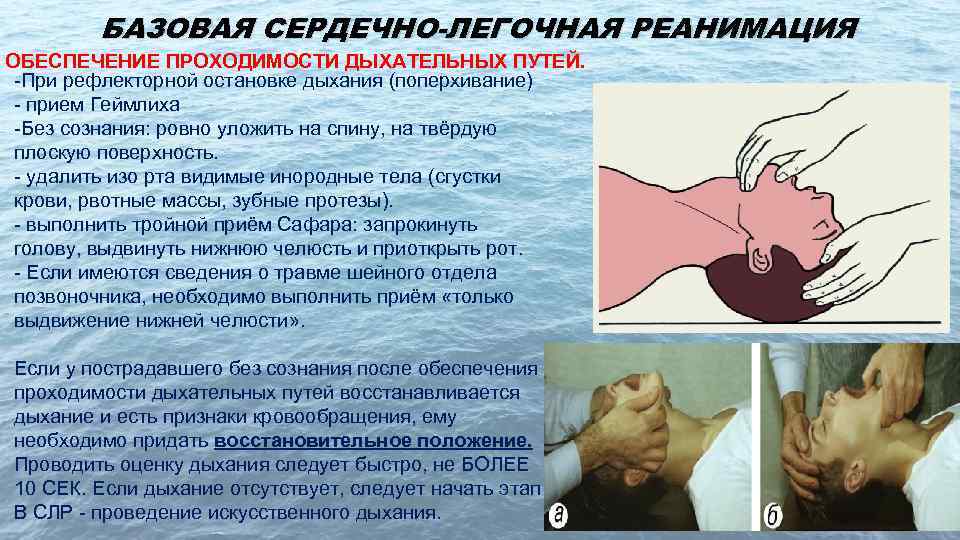 БАЗОВАЯ СЕРДЕЧНО-ЛЕГОЧНАЯ РЕАНИМАЦИЯ ОБЕСПЕЧЕНИЕ ПРОХОДИМОСТИ ДЫХАТЕЛЬНЫХ ПУТЕЙ. -При рефлекторной остановке дыхания (поперхивание) - прием