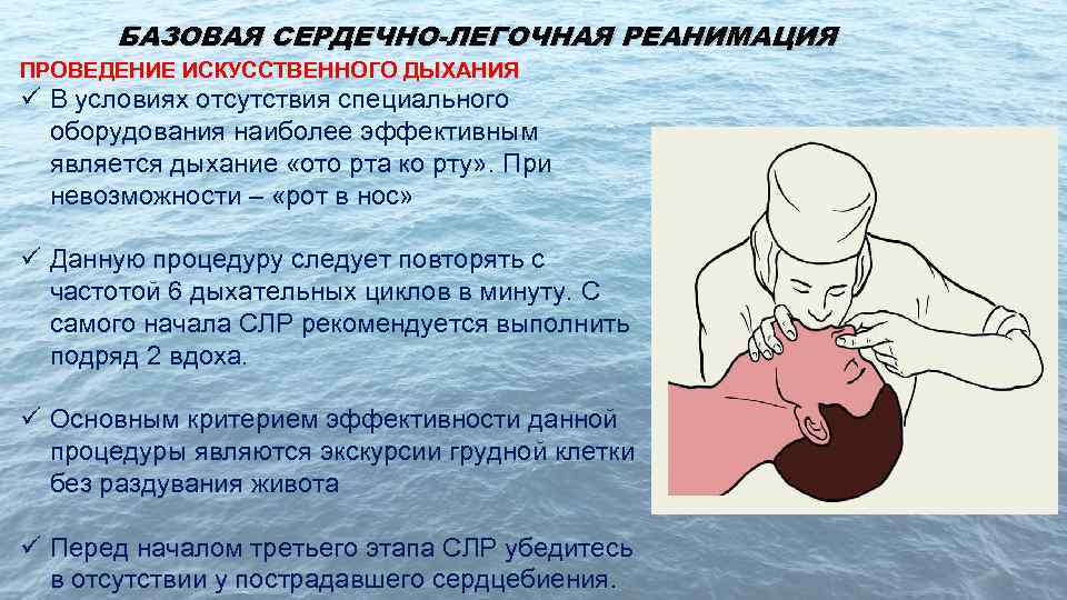 Слр новорожденных презентация