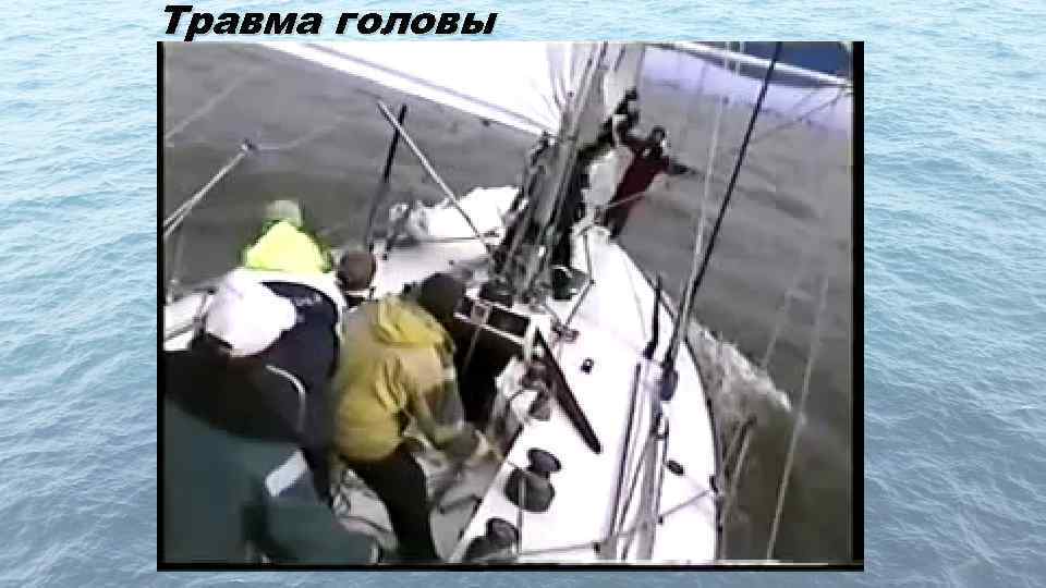 Травма головы 