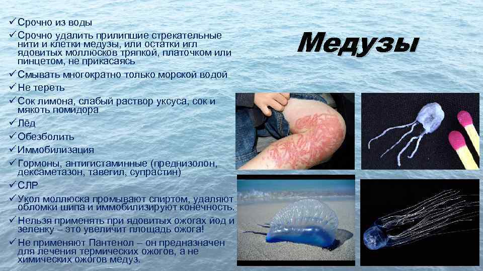 ü Срочно из воды ü Срочно удалить прилипшие стрекательные нити и клетки медузы, или