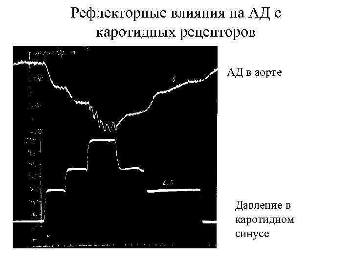 Рефлекторные влияния на АД с каротидных рецепторов АД в аорте Давление в каротидном синусе