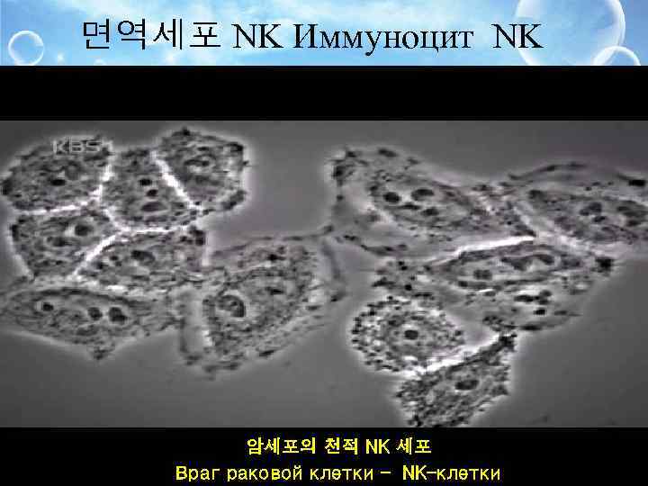 면역세포 NK Иммуноцит NK 암세포의 천적 NK 세포 Враг раковой клетки – NK-клетки 