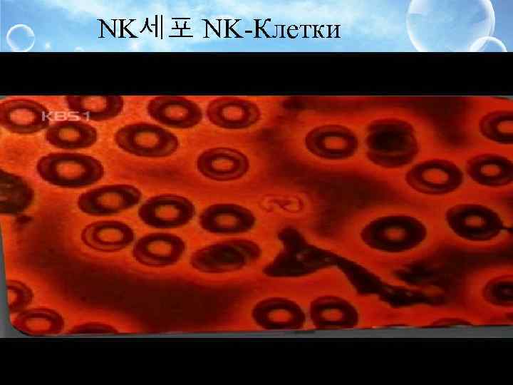 NK세포 NK-Клетки 