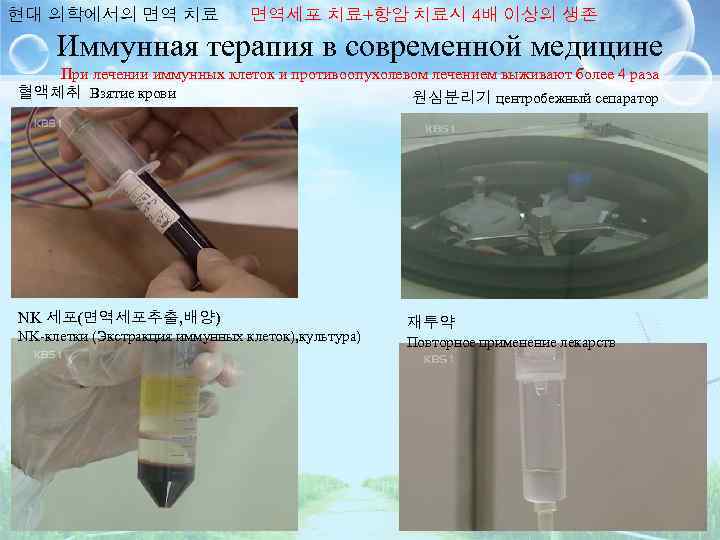 현대 의학에서의 면역 치료 면역세포 치료+항암 치료시 4배 이상의 생존 Иммунная терапия в современной