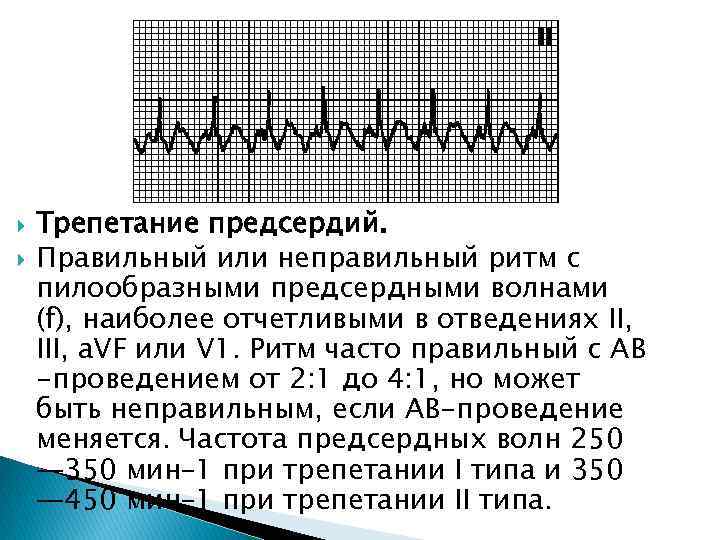  Трепетание предсердий. Правильный или неправильный ритм с пилообразными предсердными волнами (f), наиболее отчетливыми