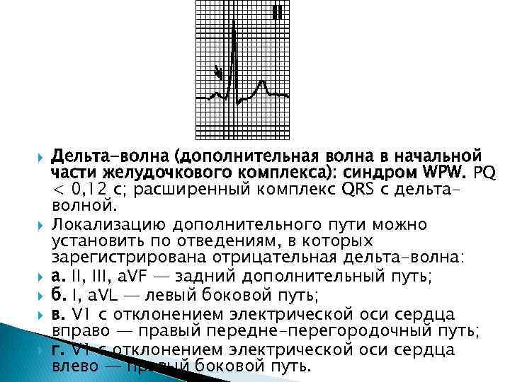  Дельта-волна (дополнительная волна в начальной части желудочкового комплекса): синдром WPW. PQ < 0,