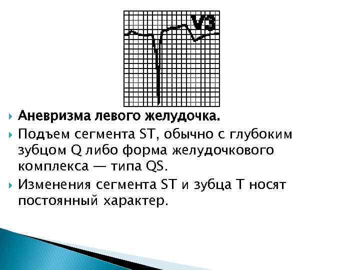  Аневризма левого желудочка. Подъем сегмента ST, обычно с глубоким зубцом Q либо форма